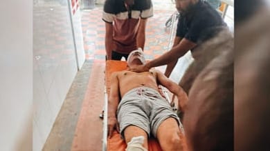 জনরোষে আহত ওবায়দুল কাদেরের ভগ্নিপতি